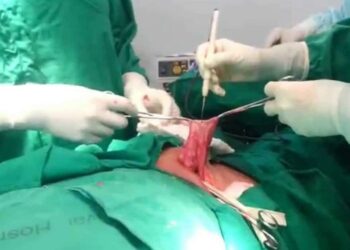 Cerca de 600 moçambicanos precisam de cirurgia para tratar hidrocele num só distrito