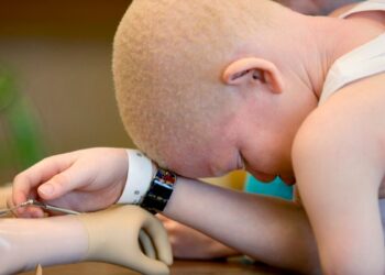 Um grupo de quatro homens amputou braço de um adolescente albino na Zambézia