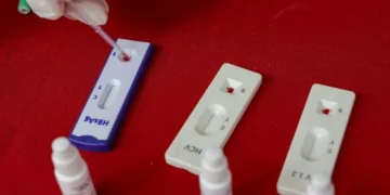 HIV: pesquisadores descobrem anti-corpo eficaz no combate ao vírus