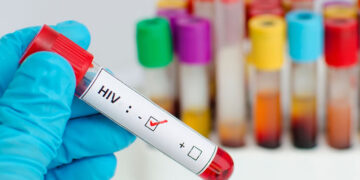 AVAC alerta para risco de retrocesso no combate ao HIV e destaca oportunidade histórica com novas tecnologias de prevenção — Moçambique entre países mais vulneráveis